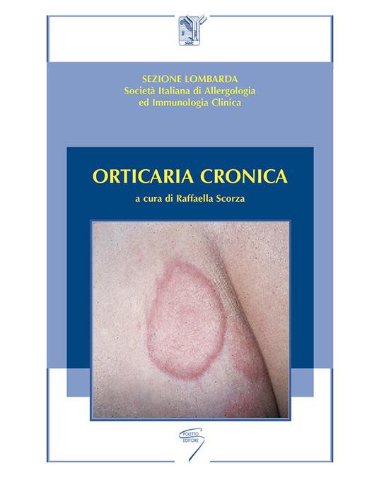 Orticaria cronica - copertina