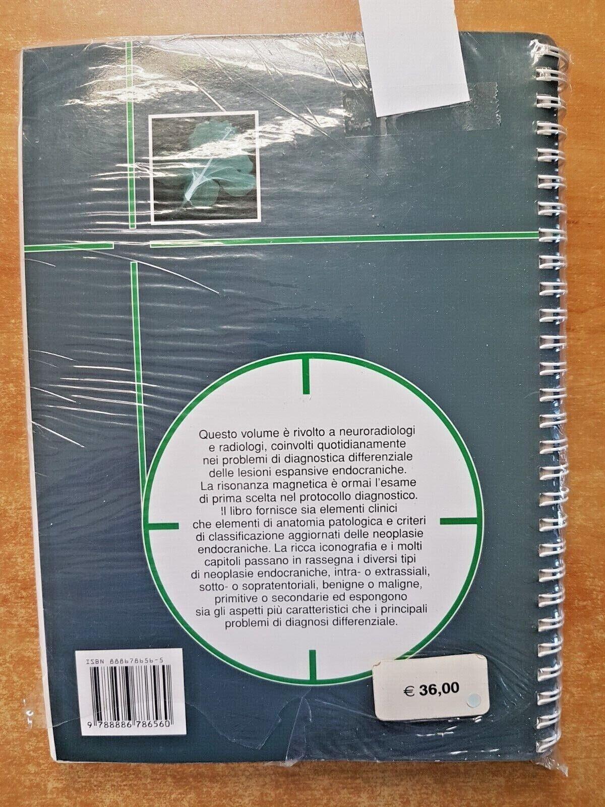 RM in neurologia (tumori cerebrali). Ediz. a spirale