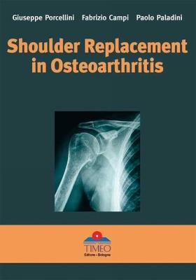 Shoulder replacement in osteoarthritis - Giuseppe Porcellini,Fabrizio Campi,Paolo Paladini - copertina