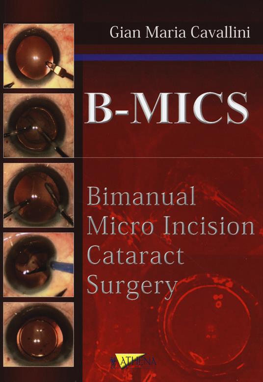 B-MICS Bimanual micro incision cataract surgery - Gian Maria Cavallini - copertina