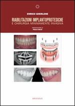 Riabilitazioni implantoprotesiche e chirurgia minimamente invasiva