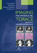 Imaging multimodale del torace. Criticità e diagnosi differenziale
