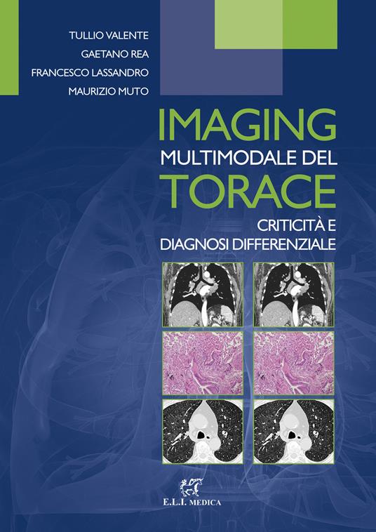 Imaging multimodale del torace. Criticità e diagnosi differenziale - Tullio Valente,Gaetano Rea,Francesco Lassandro - copertina