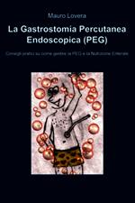 La gastrostomia percutanea endoscopica (PEG)