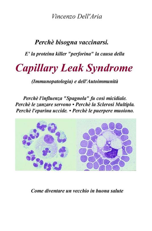 Perché bisogna vaccinarsi. È la proteina killer «perforina» la causa della Capillary Leach Syndrome (immunopatologia) e dell'autoimmunità - Vincenzo Dell'Aria - copertina