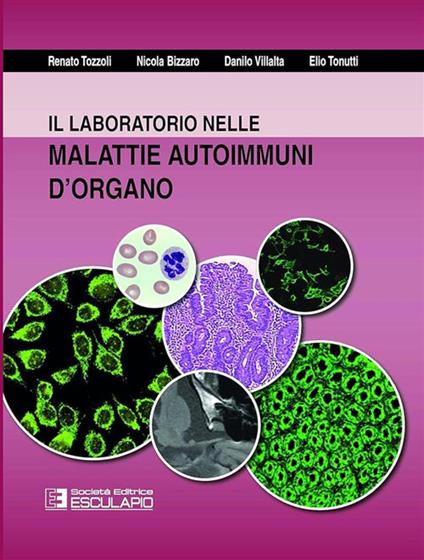 Il laboratorio nelle malattie autoimmuni d'organo - Renato Tozzoli,Nicola Bizzaro,Danilo Villalta - copertina