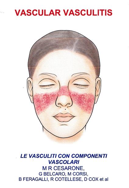 Vascular vasculitis. Vasculiti con componenti vascolari - copertina