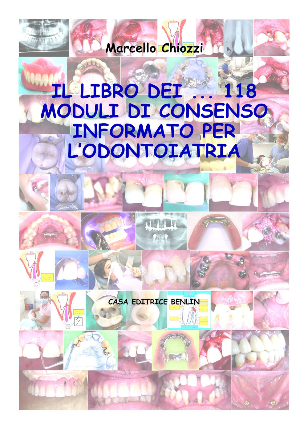 ibs