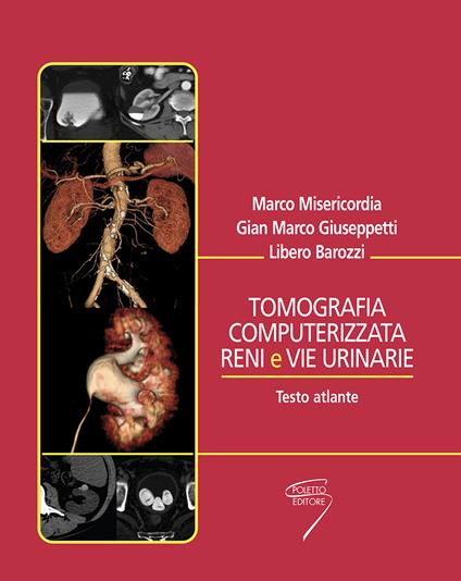Tomografia computerizzata reni e vie urinarie. Testo atlante - Marco Miserini,G. Marco Giuseppetti,Libero Barozzi - copertina