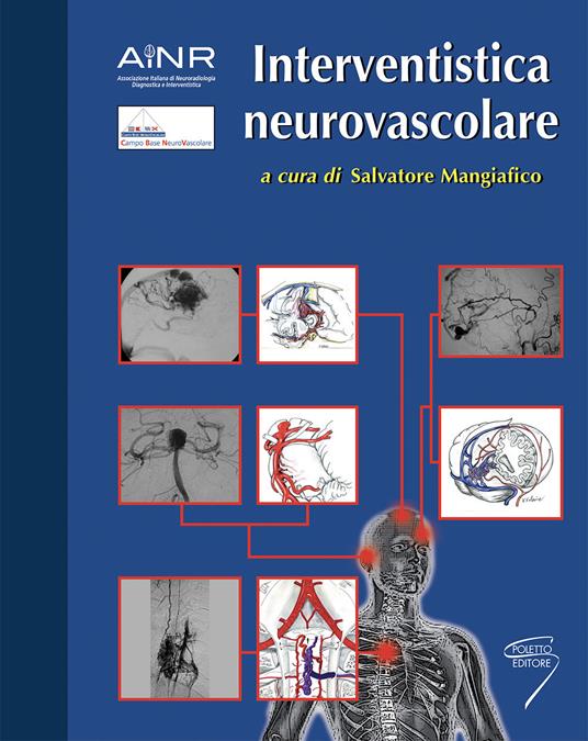 Interventistica neurovascolare - copertina