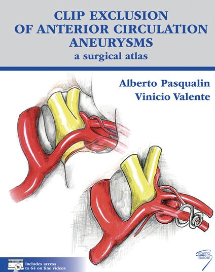 Clip exclusion of anterior circulation aneurysms: a surgical atlas. Con Contenuto digitale per download e accesso online - Alberto Pasqualin,Vinicio Valente - copertina