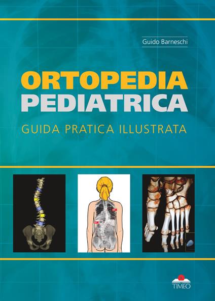 Ortopedia pediatrica. guida pratica illustrata. Ediz. illustrata - Guido Barneschi - copertina