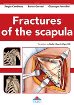 Fractures of the scapula. Ediz. illustrata