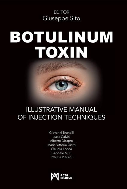 Botulinum toxin. Ilustrative manual of injection techniques. Ediz. a colori - copertina