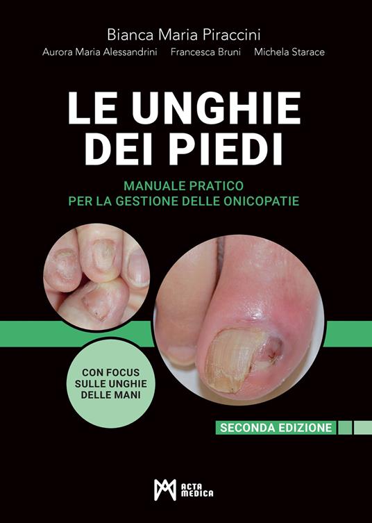 Le unghie dei piedi. Manuale pratico per la gestione delle onicopatie. Ediz. ampliata - Bianca Maria Piraccini,Aurora Maria Alessandrini,Francesca Bruni - copertina