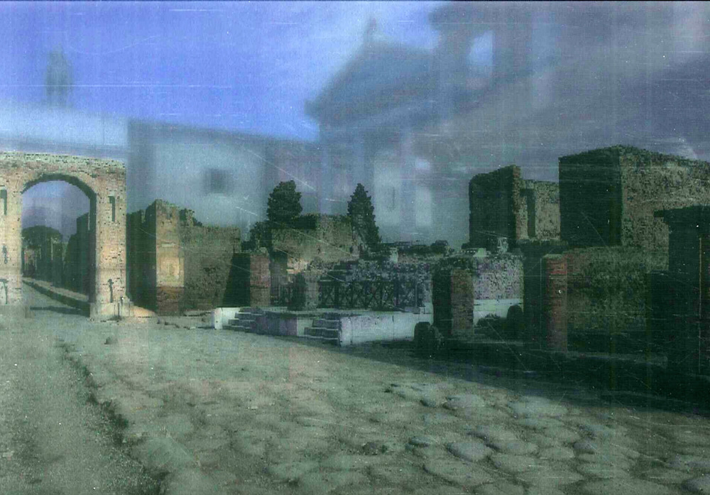 ibs