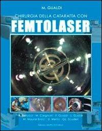 Chirurgia della cataratta con FEMTOLASER - copertina