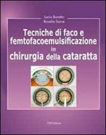 Tecniche di faco e femtofacoemulsificazione in chirurgia della cataratta