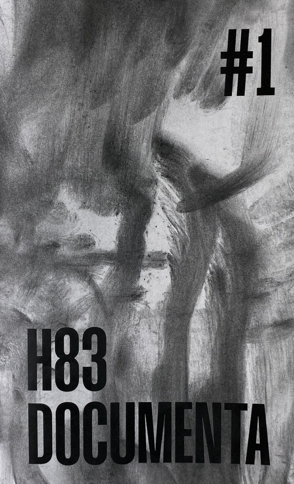ibs