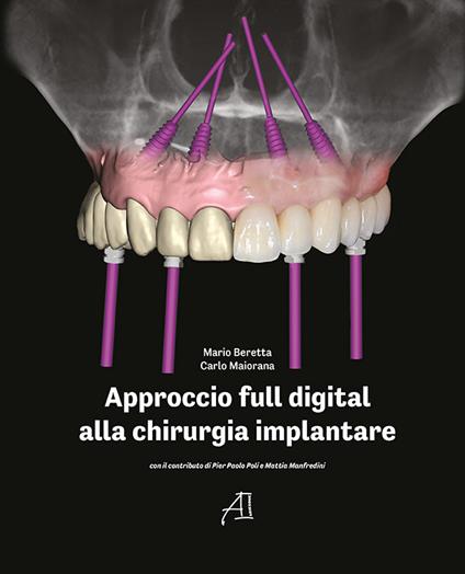 Approccio full digital alla chirurgia implantare - Carlo Maiorana,Mario Beretta - copertina
