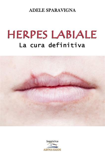 Herpes labiale. La cura definitiva - Adele Sparavigna - ebook