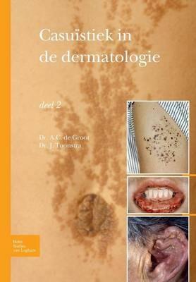 Casu?stiek in de Dermatologie - Deel 2 - Johan Toonstra - cover