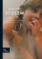 Leven Met Eczeem - P E Dirven-Meyer,Anton C de Groot - cover