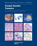 WHO classification of female genital tumours