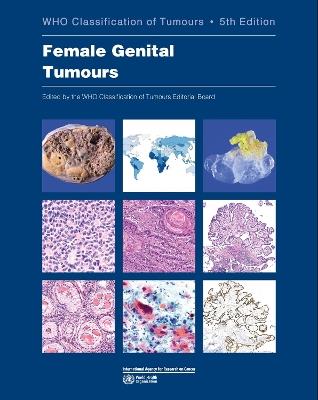 WHO classification of female genital tumours - International Agency for Research on Cancer,World Health Organization - cover
