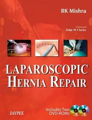 Laparoscopic Hernia Repair - RK Mishra - cover