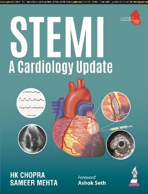STEMI: A Cardiology Update - HK Chopra - cover