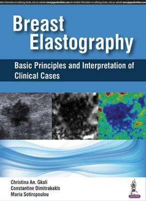 Breast Elastography: Basic Principles and Interpretation of Clinical Cases - Christina An Gkali,Constantine Dimitrakakis,Maria Sotiropoulou - cover