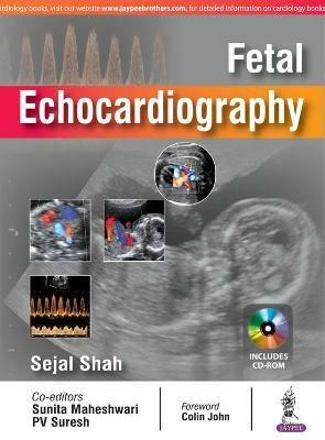 Fetal Echocardiography - Sejal Shah,Sunita Maheshwari,"Suresh" - cover