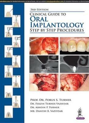 Clinical Guide to Oral Implantology: Step by Step Procedures - Porus S Turner,Ferzin Turner Vazifdar,Ashdin P Turner - cover