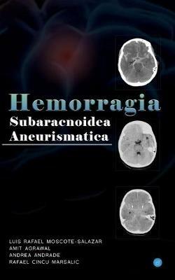 Hemorragia Subaracnoidea Aneurismatica - Amit Agrawal - cover