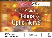 Color Atlas of Retina & Optic Nerve - Mohan Rajan,Nicey Roy Thomas - cover