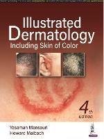 Illustrated Dermatology: Including Skin of Colour - Yasaman Mansouri,Howard Maibach - cover