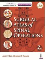Surgical Atlas of Spinal Operations