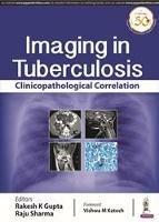 Imaging in Tuberculosis: Clinicopathological Correlation - Rakesh K Gupta,Raju Sharma - cover