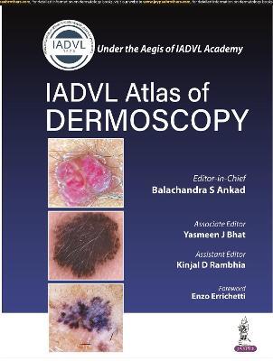 Atlas of Dermoscopy - Balachandra S Ankad,Yasmeen J Bhat,Kinjal D Rambhia - cover