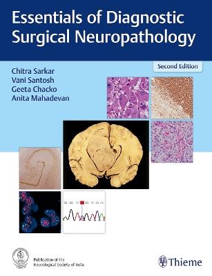 Essentials of Diagnostic Surgical Neuropathology - cover