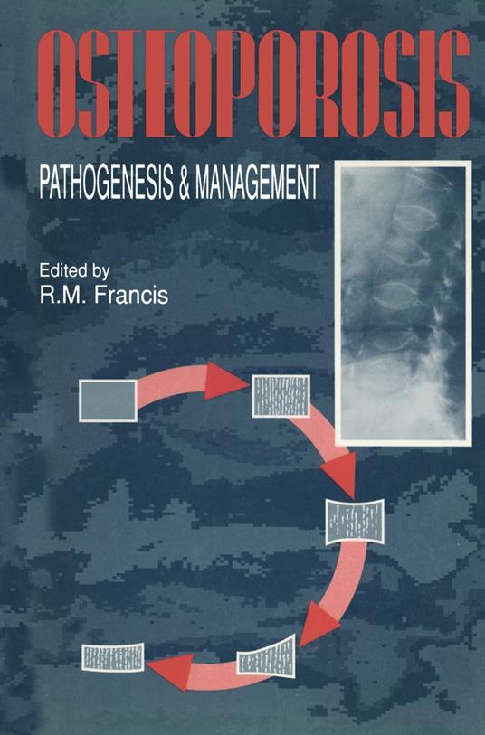 Osteoporosis