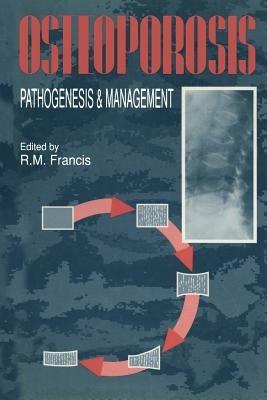Osteoporosis: Pathogenesis and Management - cover