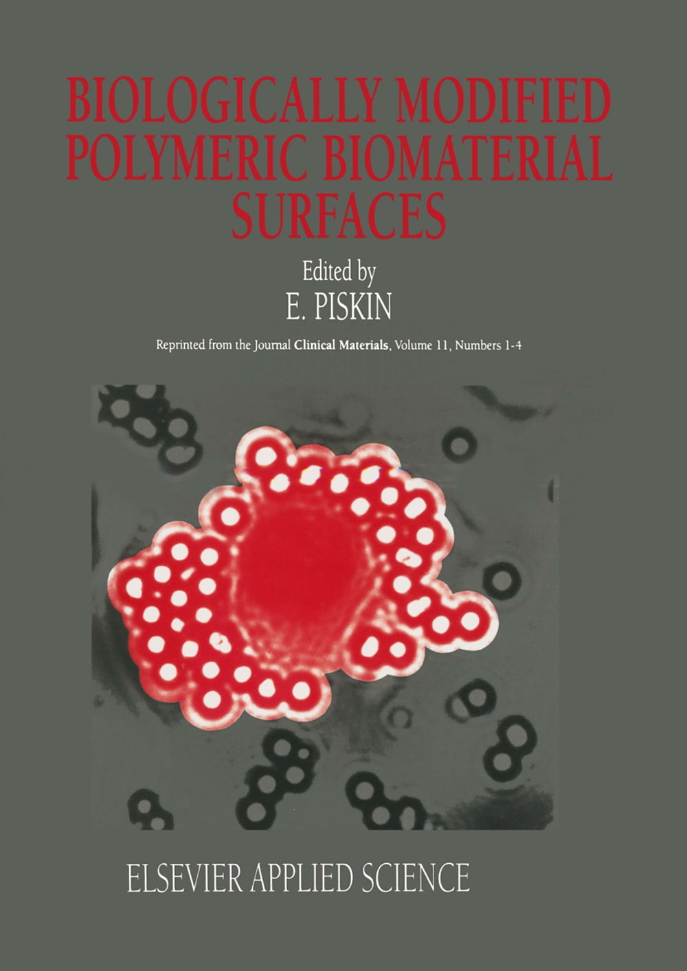 ibs