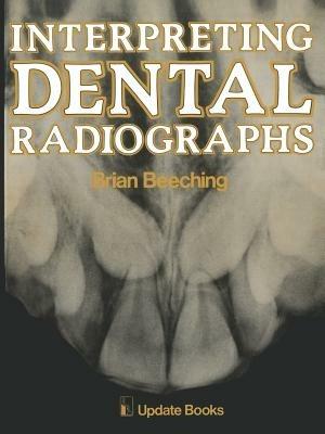 Interpreting Dental Radiographs - B.W. Beeching - cover