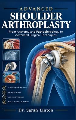 Advanced Shoulder Arthroplasty - Sarah Linton - cover