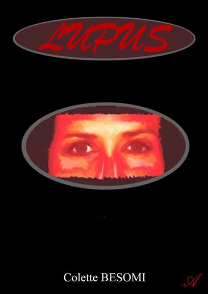 Lupus