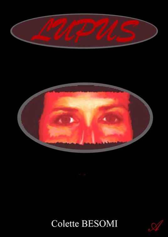 Lupus