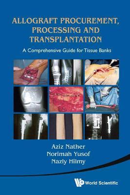 Allograft Procurement, Processing And Transplantation: A Comprehensive Guide For Tissue Banks - Abdul Aziz Nather - cover