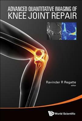 Advanced Quantitative Imaging Of Knee Joint Repair - cover